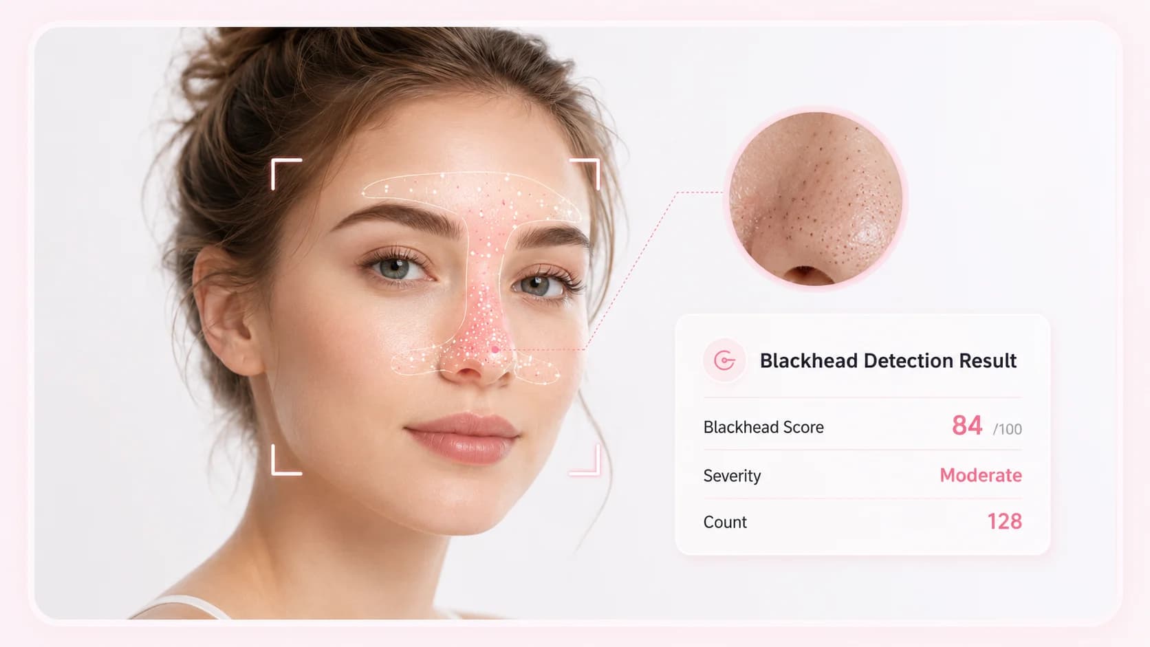 Acne scanner with pore and blackhead detection report
